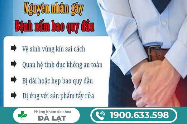 Hình ảnh minh họa